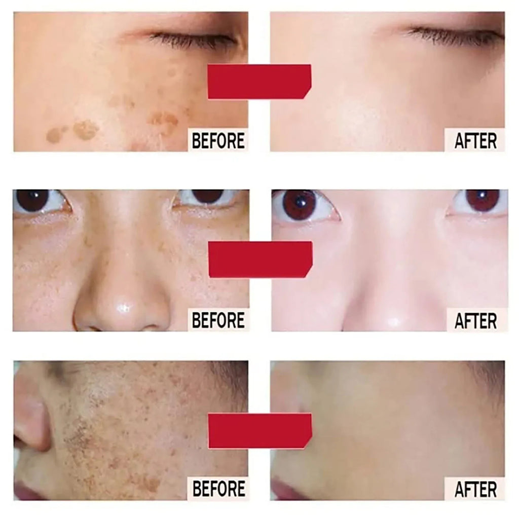 Whitening Face Cream, Reduce Dark Spots, Sun Spots, Melanin, with Collagen, Glutathione, Even Skin Tone for All Skin Types