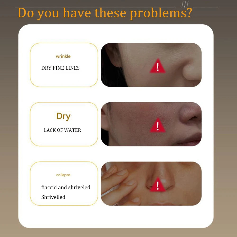 100ML Extreme Anti-Aging Essence Contains Pro Xylane Components Effectively Remove Wrinkles Always Maintain Youthfulness