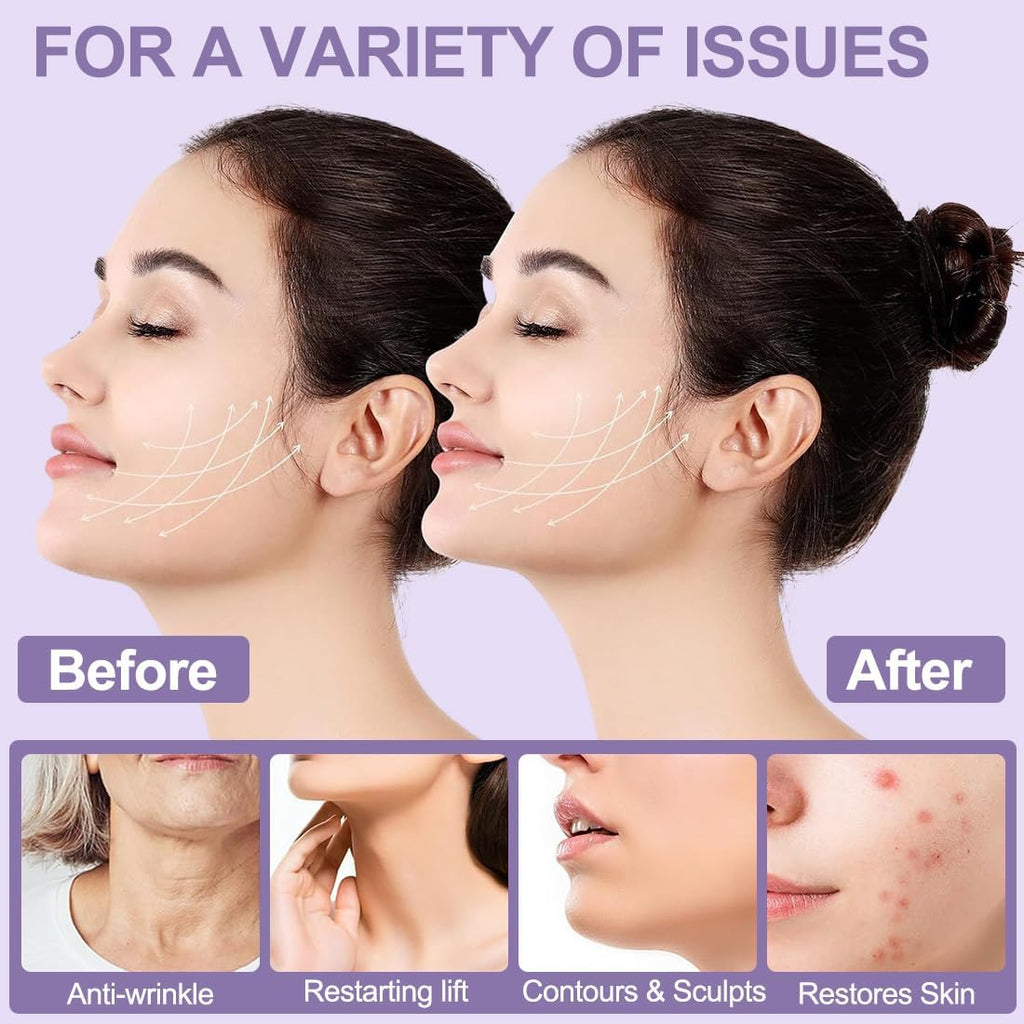 V Masque,Masque Lifting Visage,Masque De Shaper Pour Le Visage,Masque De Modelage Du Visage En V,Violet