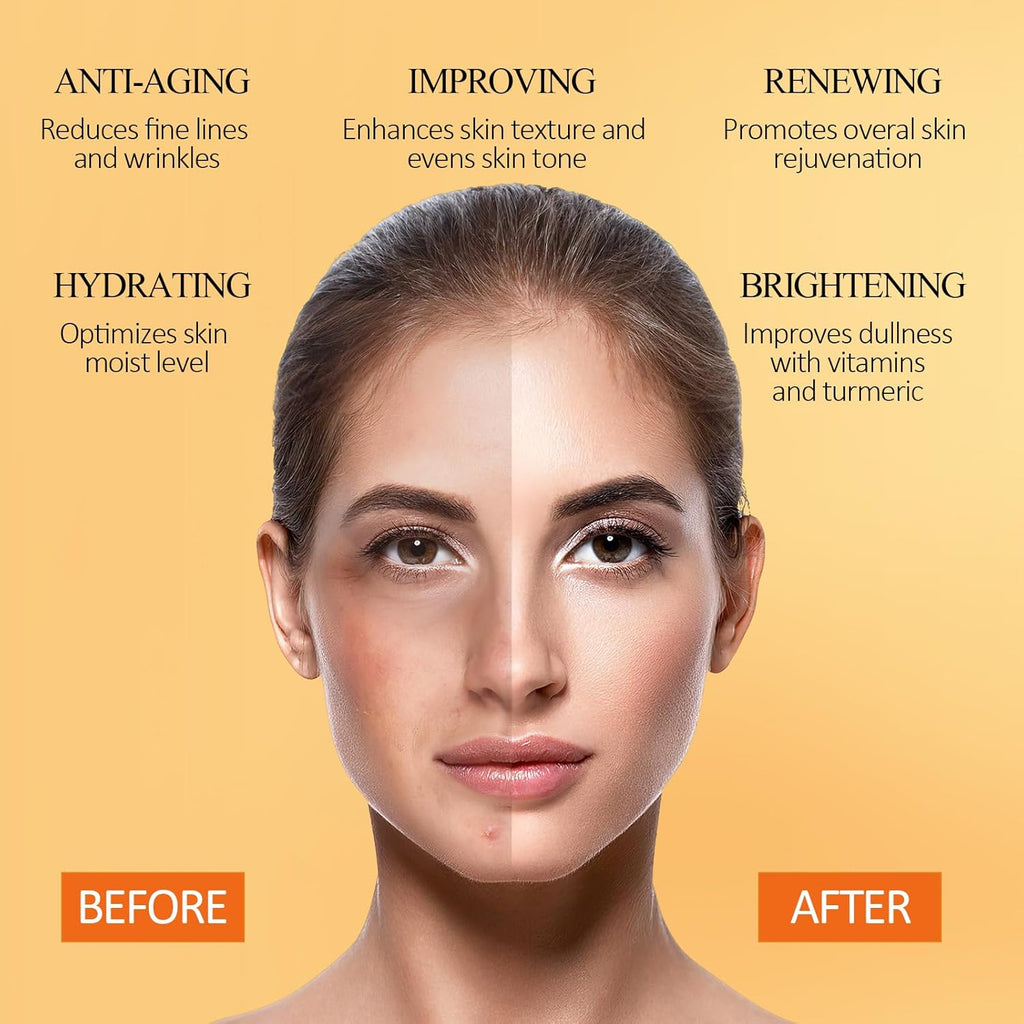 Masque À L'Argile Curcuma Et Vitamine C, Masque Facial À L'Argile Kaolin Pour Les Taches Brunes, Contrôle L'Acné, Le Sébum Et Affine Les Pores, Uniformise Le Teint, Nettoie En Profondeur 150G