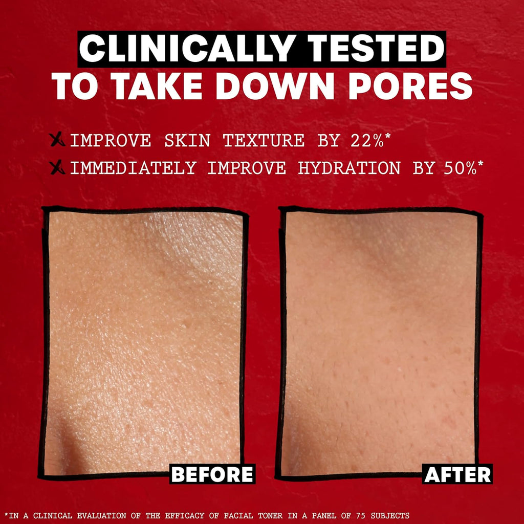 Thayers Lotion Tonique Douce - Pétale De Rose, Hamamélis & Aloe Vera Bio - Hydratation & Pores Resserrés - Sans Cruauté Animale - Sans Alcool - Vegan - 98% D'Ingrédients Naturels - 355 Ml